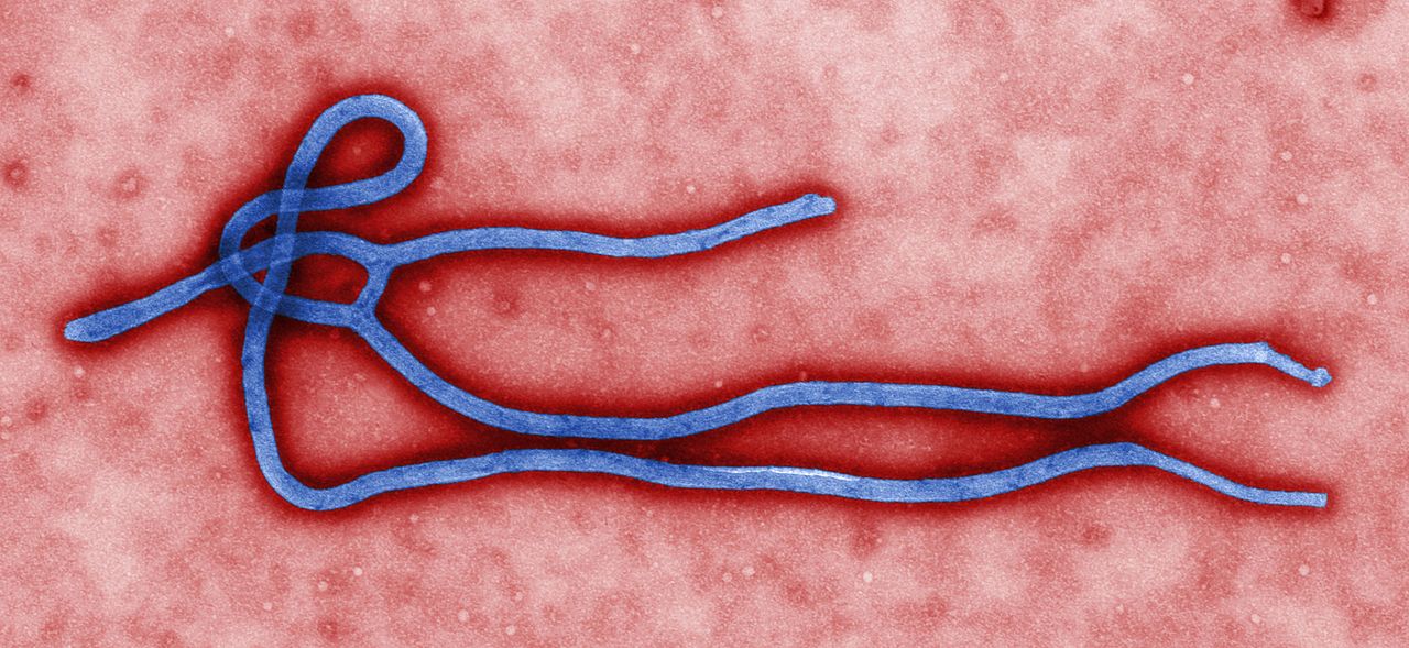 ebola_virus_virion.jpg