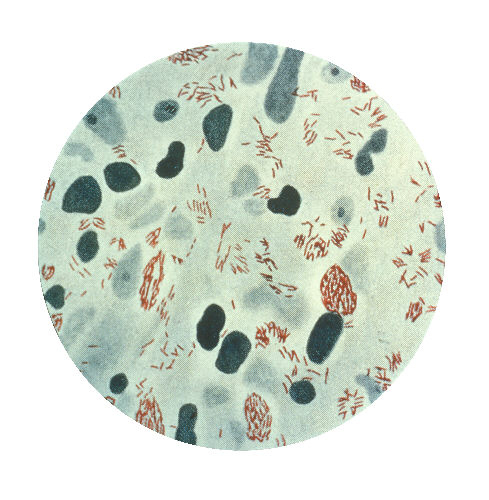 Mycobacterium_leprae.jpeg