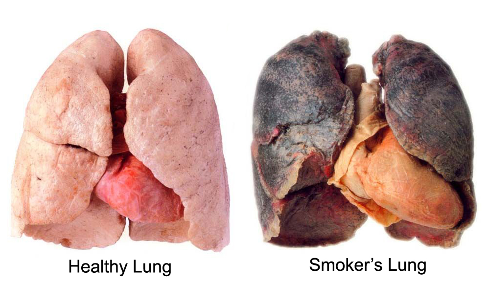 tüdő dohányzás veszélye