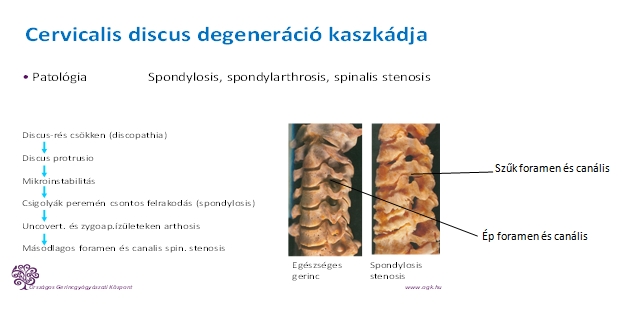 gerinc és látás milyen egyszerű a látás javítása
