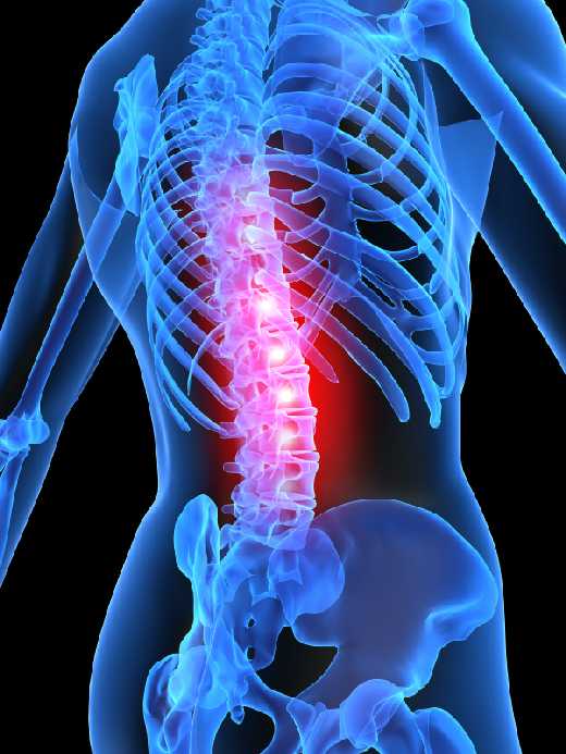 A gerinc sérüléseiről: könnyen végzetes lehet | Magyar Nemzet