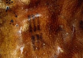szalagféreg féreg hogyan lehet azonosítani giardia férgek pinworms