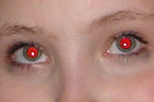 látás vörös szemek)