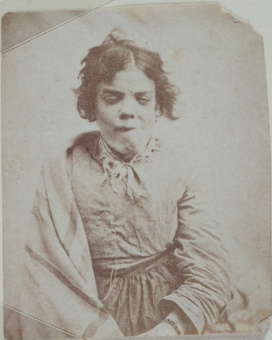 Portrait_of_a_patient,_Surrey_County_Asylum.jpg