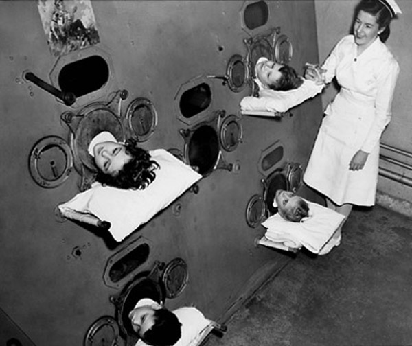 1937. Gyermekbénulásban szenvedő gyerekek vastüdőben. Nyaktól lefelé bénultaknak a gép mozgatta a mellkasát 24 órában. A vakcina a betegségre 1955-ben jelent meg..jpg