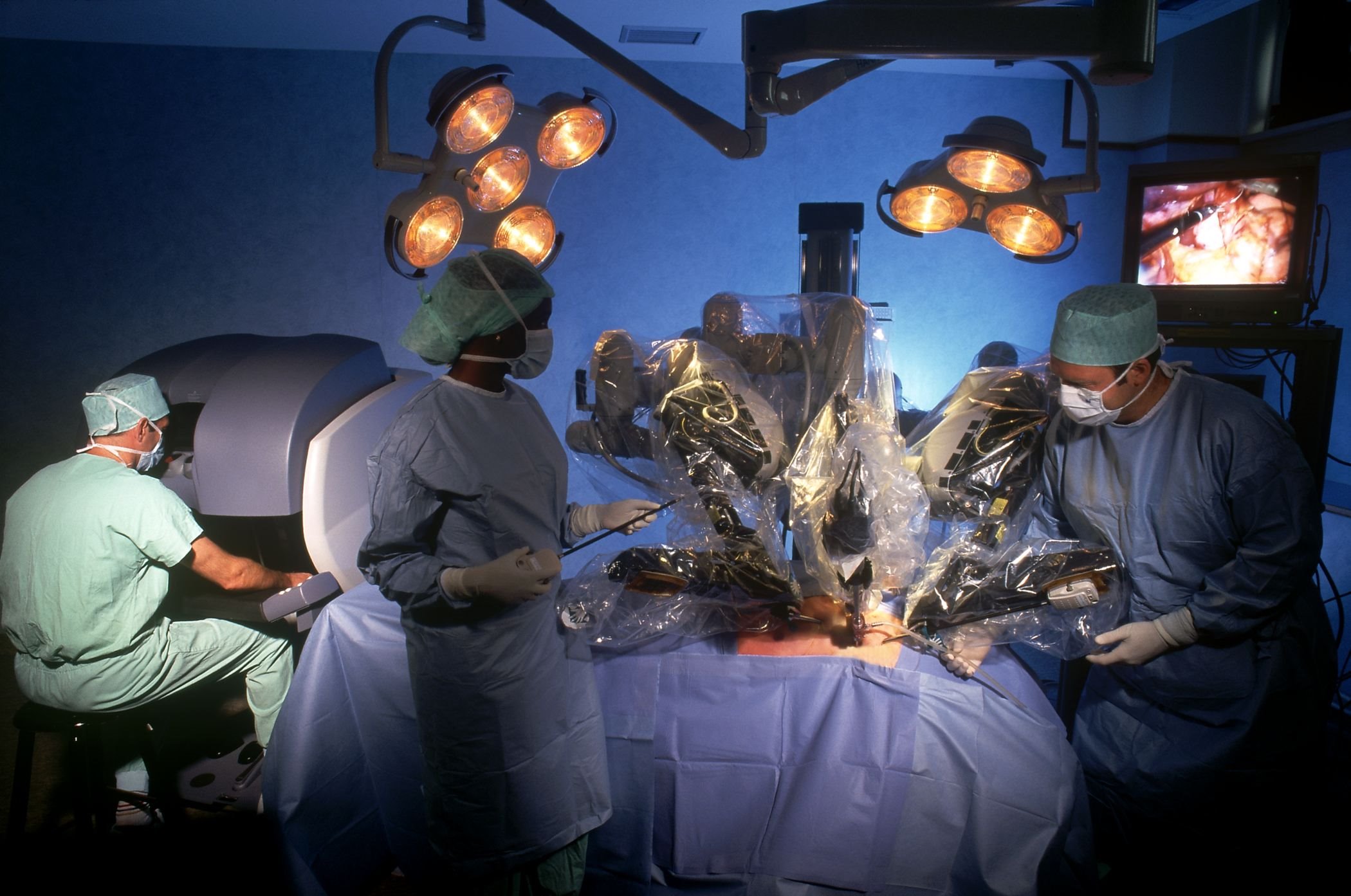 A sebészeti robotok evolúciója