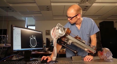 Agyi vérömlenyeket felszívó sebész robot