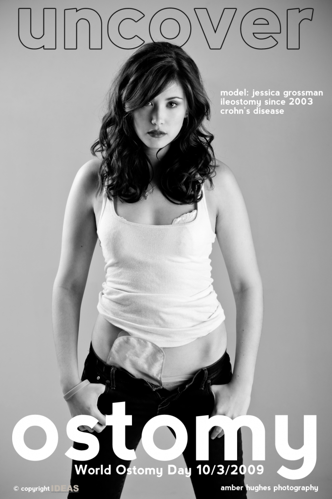a_portrait_of_model_jessica_grossman_for_the_uncover_ostomy_campaign_1-682x1024.png